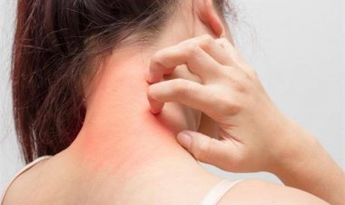 बरसात में स्किन एलर्जी से परेशान हैं, तो इन 5 उपायों से करें उपचार