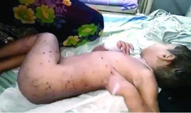 दो साल की बच्ची को उठा ले गए कुत्ते, हालत गंभीर