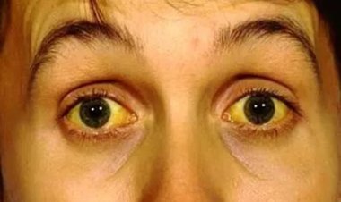 एक दर्जन छात्राएं बीमार, दो एम्स में भर्ती