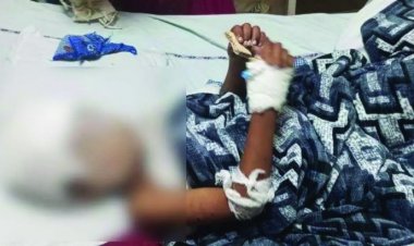 आवारा कुत्तों ने 6 साल के बच्चे पर किया जानलेवा हमला, नोच खाया सिर और पीठ का मांस