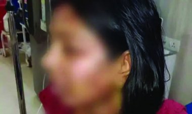 रायगढ़  250 रुपए के लिए पत्नी के ऊपर पति ने फेंका खौलता हुआ गर्म दाल