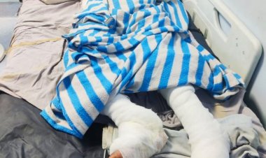 आग से 70 % जली महिला, मौत से लड़ रही जंग, परिजनों ने ससुराल पक्ष पर लगाएं कई गंभीर आरोप,