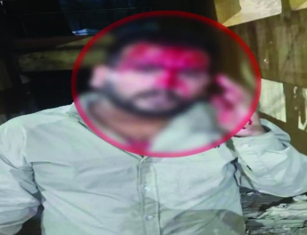 रायपुर  रायपुर में गैंगवार: दो गुटों के बीच चाकूबाजी और मारपीट, युवक गंभीर घायल